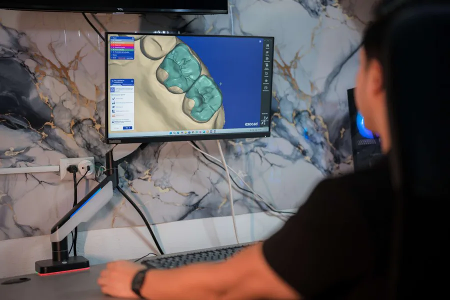 Digital dental restoration being designed on screen