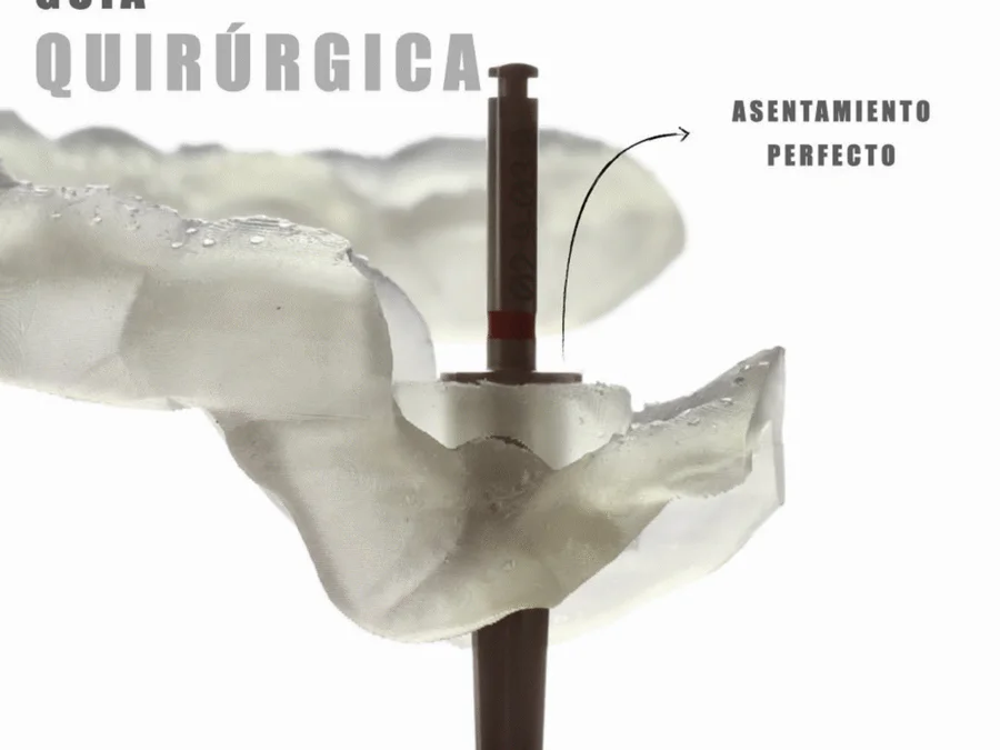 Digitally designed guidance for precise drill seating, implant angulation, and depth.
