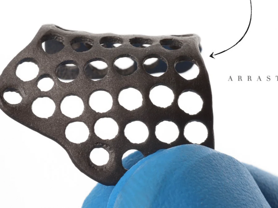 A custom titanium mesh supports predictable three-dimensional bone augmentation.