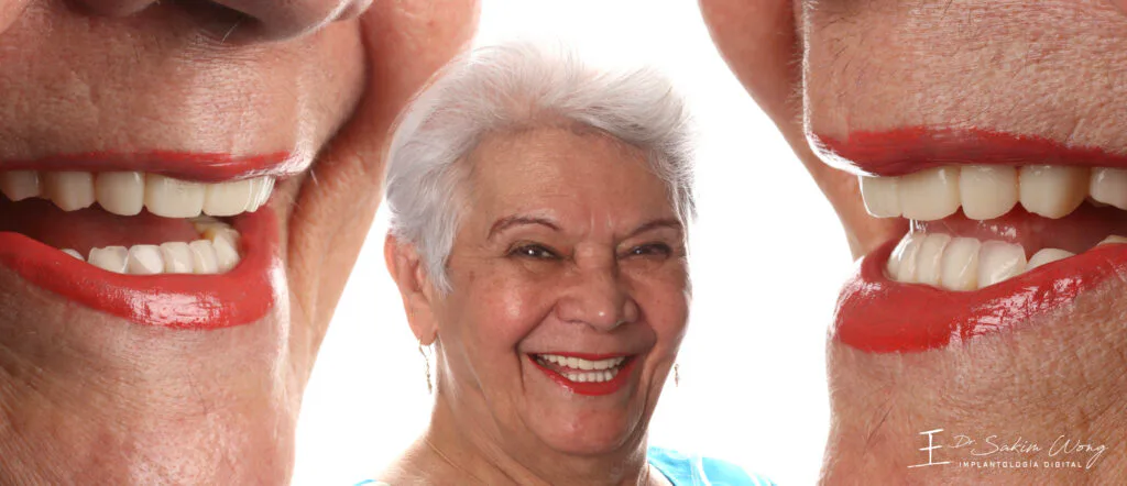 Patient after implant rehabilitation